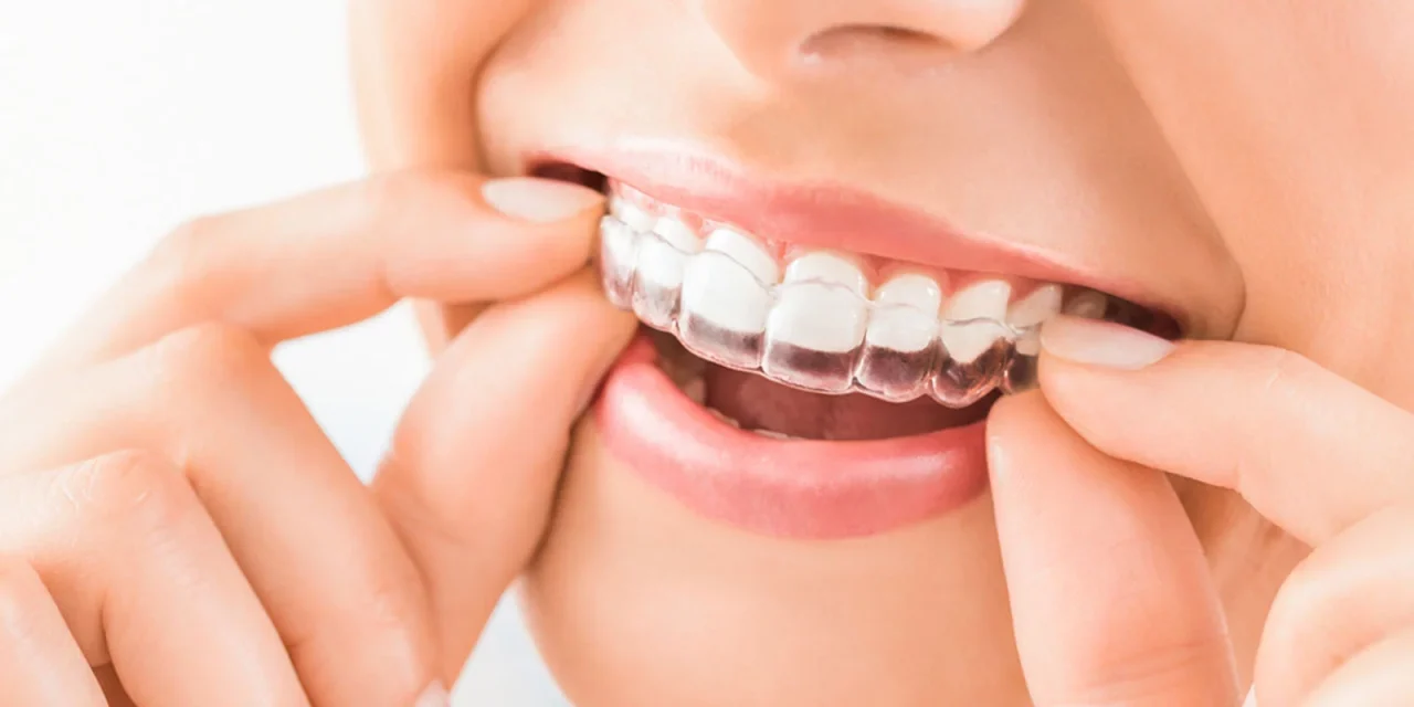 Invisalign Tedavisi: Şeffaf ve Rahat Ortodontik Düzeltme